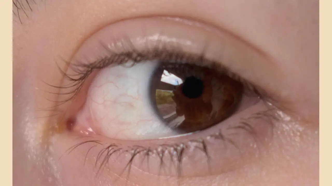 The Sclera (White) Can Be Either Pure Or Slightly Tinted Blue, Depending On The Person's Ethnicity